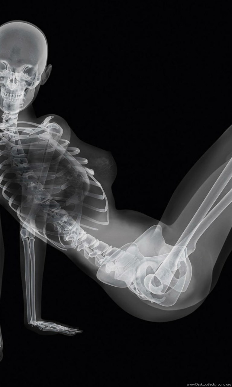 X ray РѕР±РѕРё