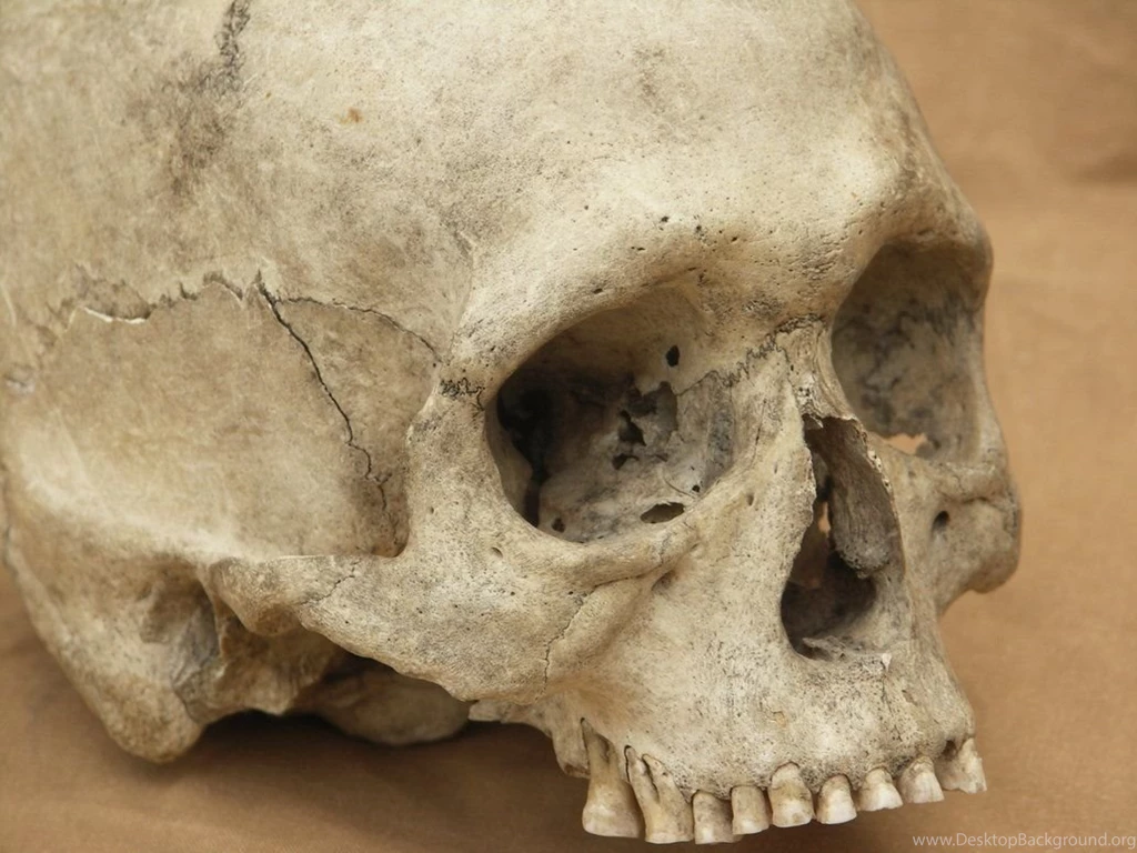 Human Skull 14 Jpeg By Pronus On DeviantArt