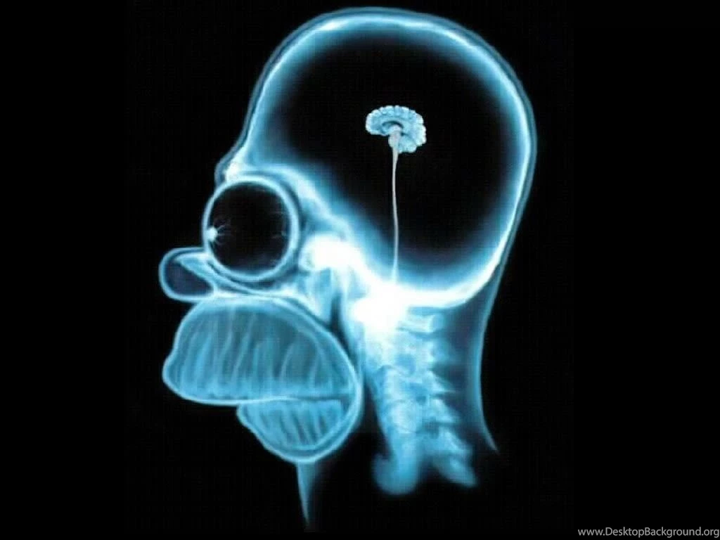 Homer Brain X Ray The Simpsons Wallpapers (60337) Fanpop