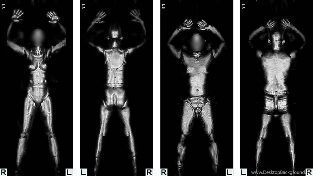 Airport X Ray Pictures Wallpapers HD 1920x1080