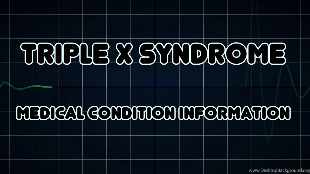 Triple X Syndrome (Medical Condition) YouTube