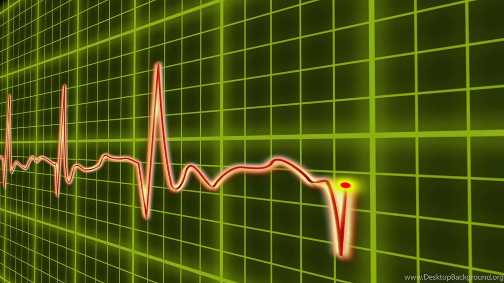 EKG Cardio Heart Beat, Normal And Zero Pulse With Audio. Stock ...