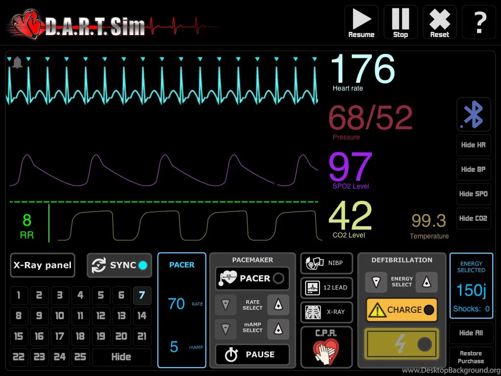 D.A.R.T. ECG Simulator PC/MAC Computer (Download) 2 Licenses – ECG ...