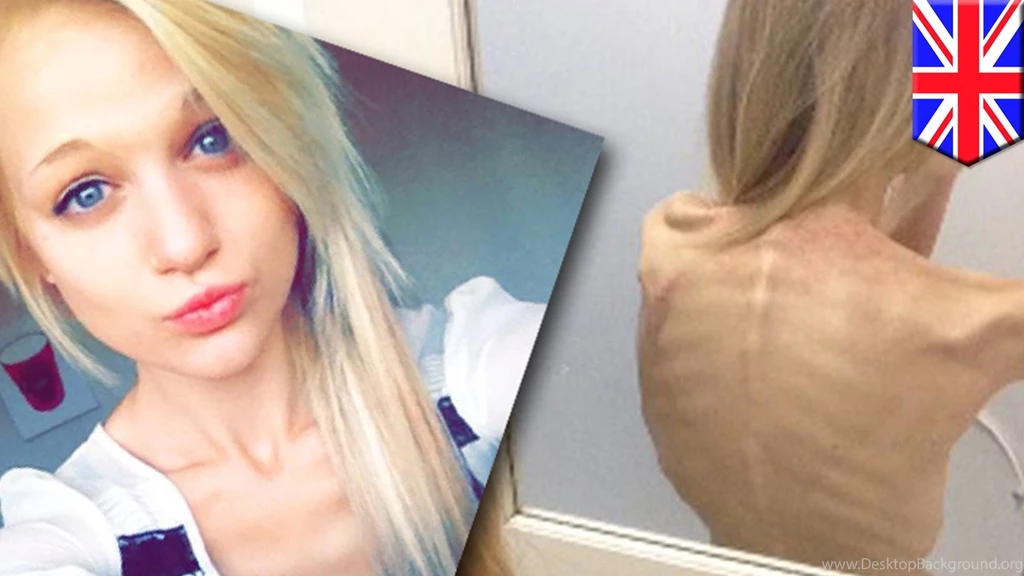 Eating Disorders: Pro ana Websites And Thinspiration Photos Almost ...