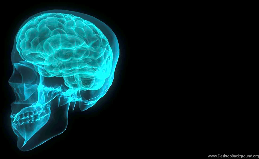 Skull Brain X ray
