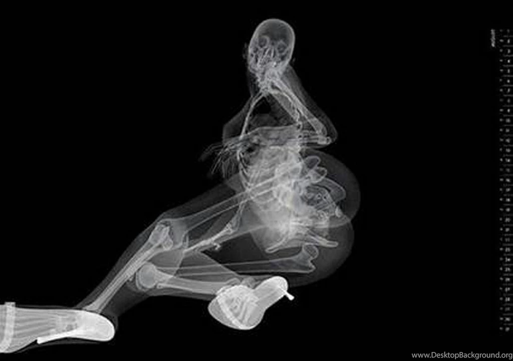 Download A X Ray Calendar 005.jpg Wallpapers For Your Desktop One ...