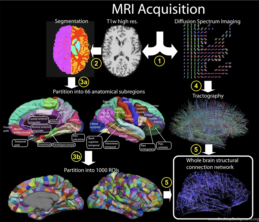 Fmri Versus Dsi Stand Back Going To Try Neuroscience High ...