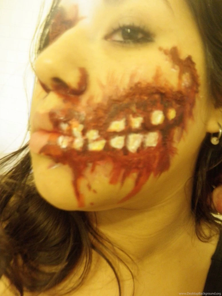 Fucked Up Teeth By Rcorpse On DeviantArt