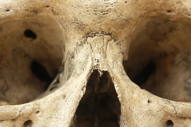 Human Skull 15 Jpeg By Pronus On DeviantArt