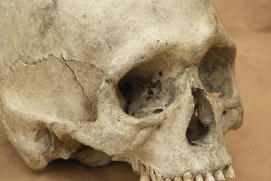 Human Skull 14 Jpeg By Pronus On DeviantArt