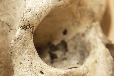 Human Skull 03 Jpeg By Pronus On DeviantArt