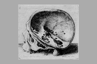 Aufgesägter Human Skull , Hollar Wenzel Wallpapers