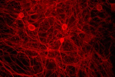 Press Release :: Ibidi