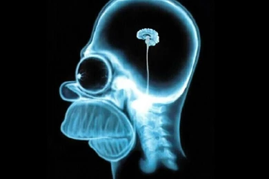 Homer Brain X Ray   The Simpsons Wallpapers (60337)   Fanpop