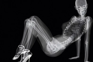 Funny Girl X Ray HD Wallpapers On MobDecor Http://www.mobdecor.com ...