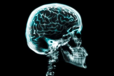 X Rays   4   Wallpapers   FreezeWall