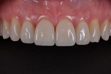 Dental Photography Pearls For Better Images Instantly: An Easy ...