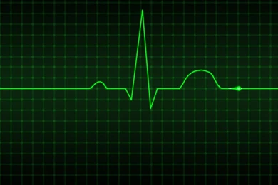 ECG Wallpapers   Bing Images