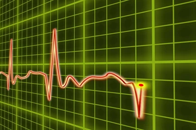 EKG Cardio Heart Beat, Normal And Zero Pulse With Audio. Stock ...