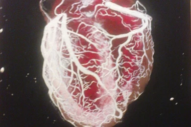 Human Heart By Cymue On DeviantArt
