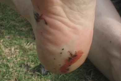 Fun Trips That Are Not Fun Anymore