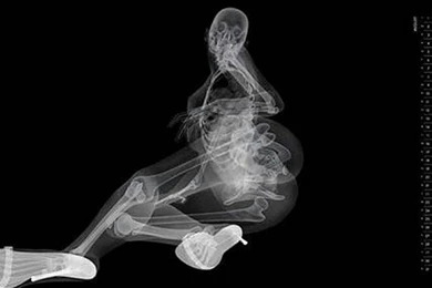 Download A X Ray Calendar 005.jpg Wallpapers For Your Desktop One ...