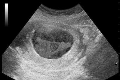 Pictures With Patrick