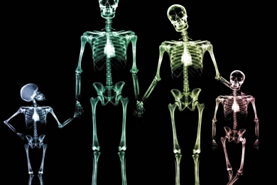 Incredible Human X Ray Pictures   Photoshop / Graphics 626