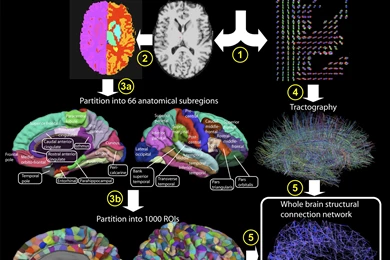 Fmri Versus Dsi Stand Back Going To Try Neuroscience High ...