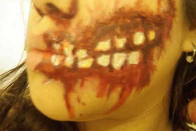 Fucked Up Teeth By Rcorpse On DeviantArt